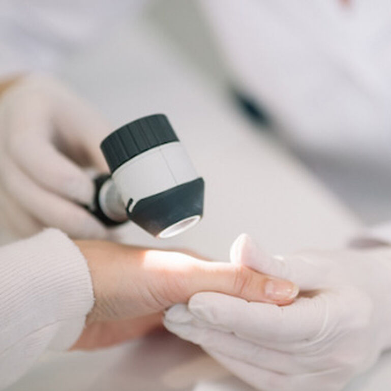 Phycian examining for melanoma